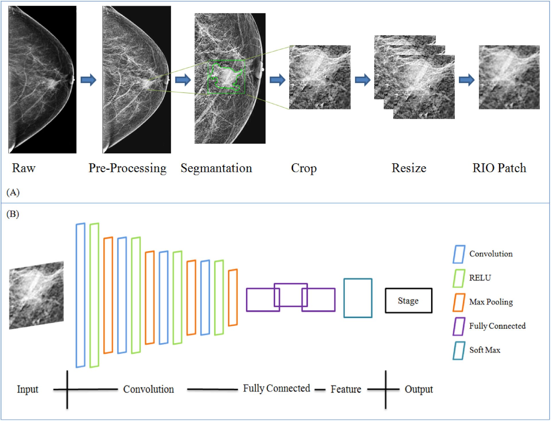 AI Innovations in Early Breast Cancer Detection - NHSJS