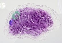 Sex-Specific Differences in Alzheimer’s Disease