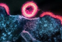 Ethnic-Specific Gene Expression Patterns Impacting Prostate Cancer in African-American Men