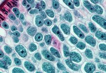 Targeted Biologic Therapies in Myasthenia Gravis: Advances in Complement and FcRn Inhibition