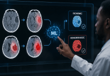 Classifying Ischemic and Hemorrhagic Strokes Using Machine Learning To Administer Accurate Treatment