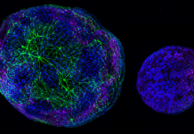 A-Klotho Deficiency is Associated with Rapid Progression of Learning and Cognitive Impairment as well as Early Senescence in Brain Organoids Derived from Alzheimer’s Disease Transgenic Mice