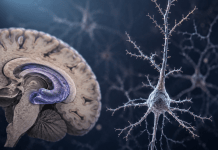 Unveiling the Intrinsic Properties of Pyramidal Neurons In the Hippocampal Area Under AD