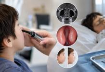 Deviated Nasal Septum and Sinusitis with Turbinate Hypertrophy in Pediatric Patients: Implications for Facial Development, Disordered Sleep, and Post-surgical Complications