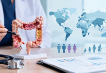 Global Trends, Geographic Variation, and Sex and Age Disparities in Colorectal Cancer Burden, 2013-2023: A Descriptive Analysis of the GBD 2023 Study
